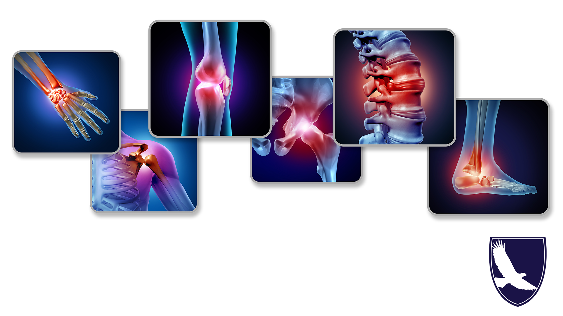 CAN I GET SSDI DISABILITY FOR RHEUMATOID ARTHRITIS